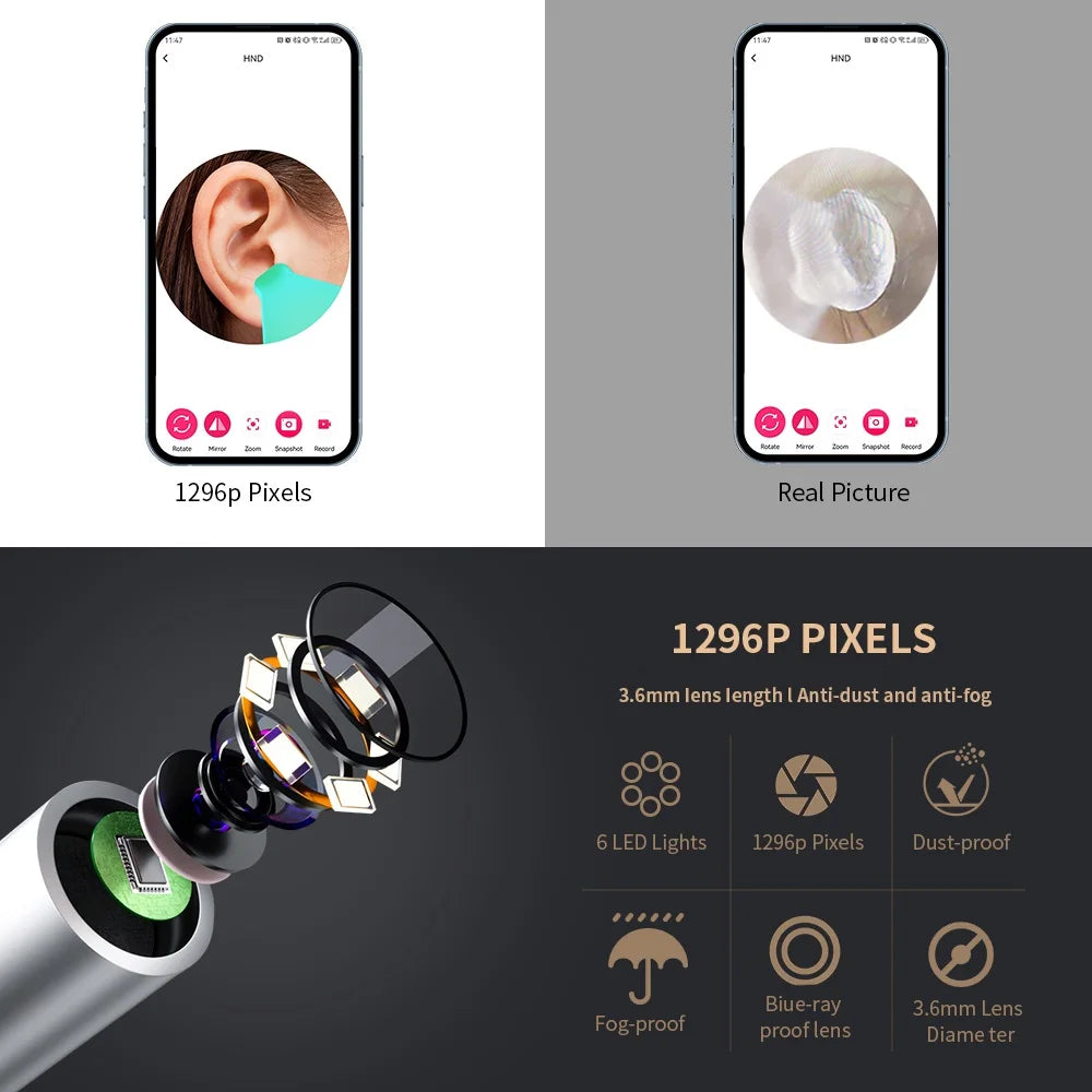 Smart Ear Cleaner — HD Camera & WiFi