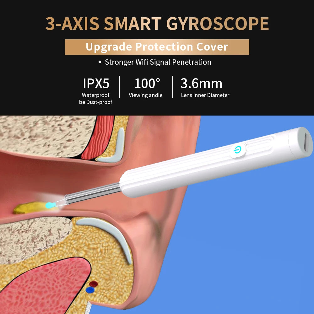 Smart Ear Cleaner — HD Camera & WiFi